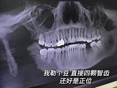 -极光口腔·矫正种植修复(锦江店)