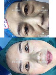 -郡艺医疗美容·微整·眼鼻吸脂