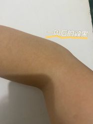 体验后-海峡医疗美容医院