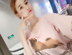 点击看大图 -大麦微针植发丨全国连锁