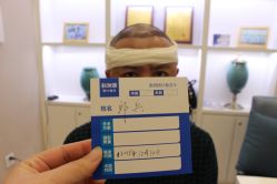 -大麦微针植发丨全国连锁