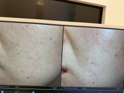 -苑苑vbeauty科技美容SPA