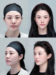 -深圳艺星医疗美容医院