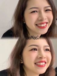 -YooMee优美智能科技美肤机构