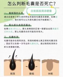 -诗碧曼养发