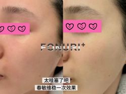 -春田皮肤管理中心品牌旗舰店