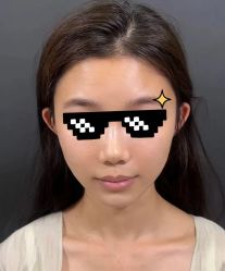 -天津健丽·去眼袋医疗美容机构