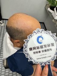 -唐风采假发补发定制