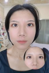 -西施无菌半永久纹绣眉眼影唇轻增发纹发际线