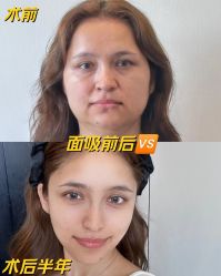-Yestar艺星医疗美容医院