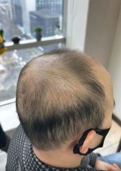 -唐风采假发补发定制