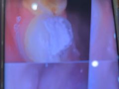 -土豆口腔(凤凰北总店)