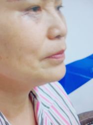 -郡艺医疗美容·微整·眼鼻吸脂