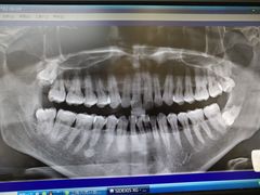 -天使口腔门诊部(上海店)