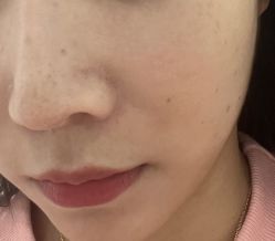 -慕颜医疗美容·皮肤微整 抗衰