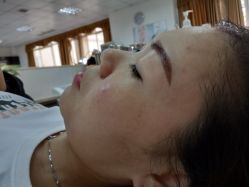 -悟空祛痘·专业祛痘机构