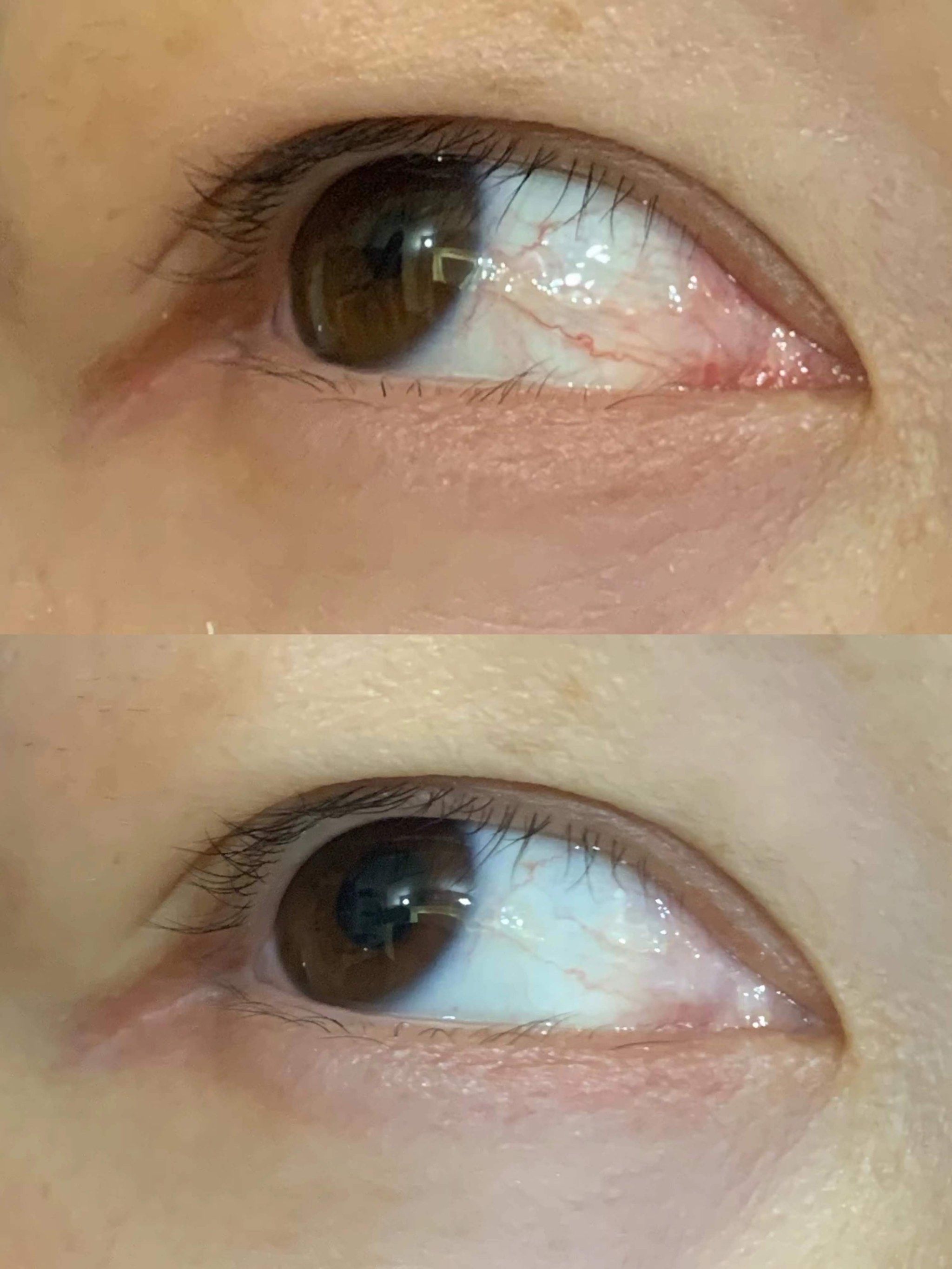 可以改变眼球的眼部抗衰