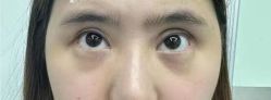 -素美医疗美容·西南眼鼻整形·修复基地