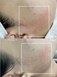 -E.beauty驻颜·痘敏肌调理中心