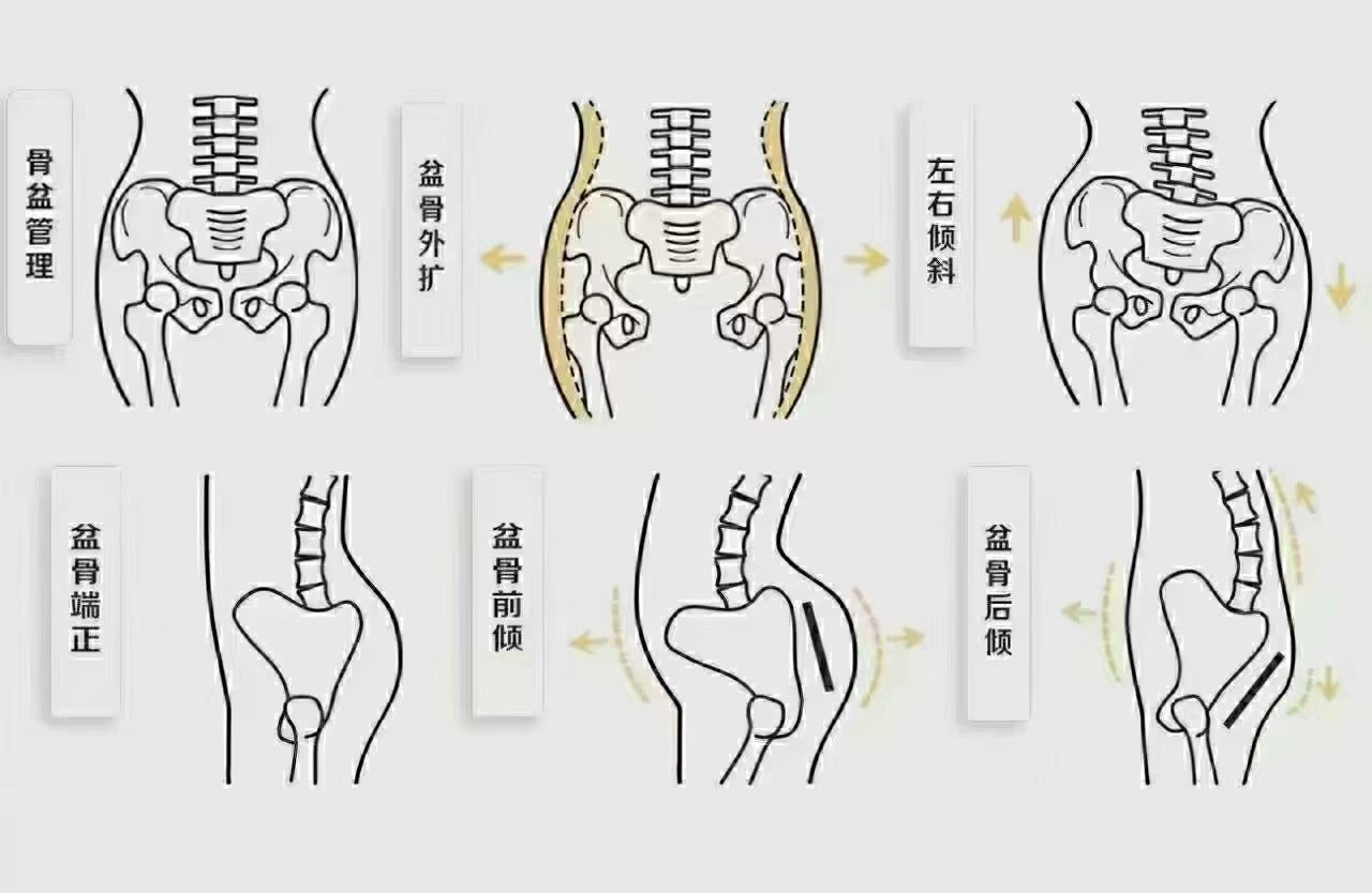 跷二郎腿骨盆图片