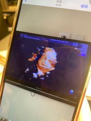 -杭州贝瑞斯美华妇儿医院·早孕·产检·儿科