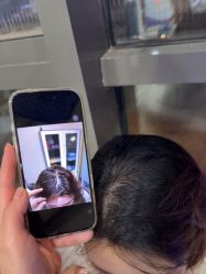 -碧莲盛·不剃发植发