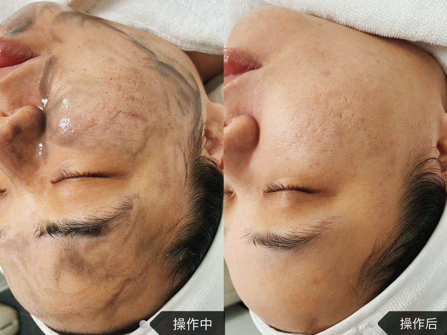 黑科技排毒清洁高科技