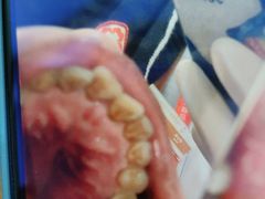 -宁波壹加壹口腔·矫正种植中心