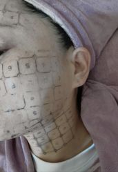 -深圳阳光医疗美容