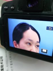 体验后-西安壹加壹医疗美容·西北抗衰旗舰店