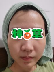 体验后-圣嘉新医疗美容医院