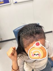 -大麦微针植发全国连锁