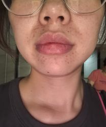 体验后-重庆军科整形美容医院