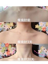 -上海时光整形外科医院
