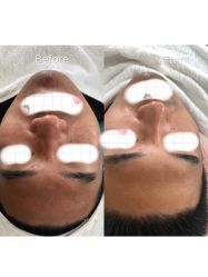 -skin79皮肤管理基站