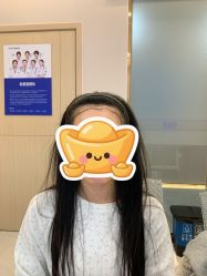 -碧莲盛不剃发植发