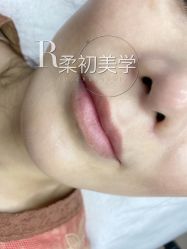 -RC半永久纹眉纹发际线