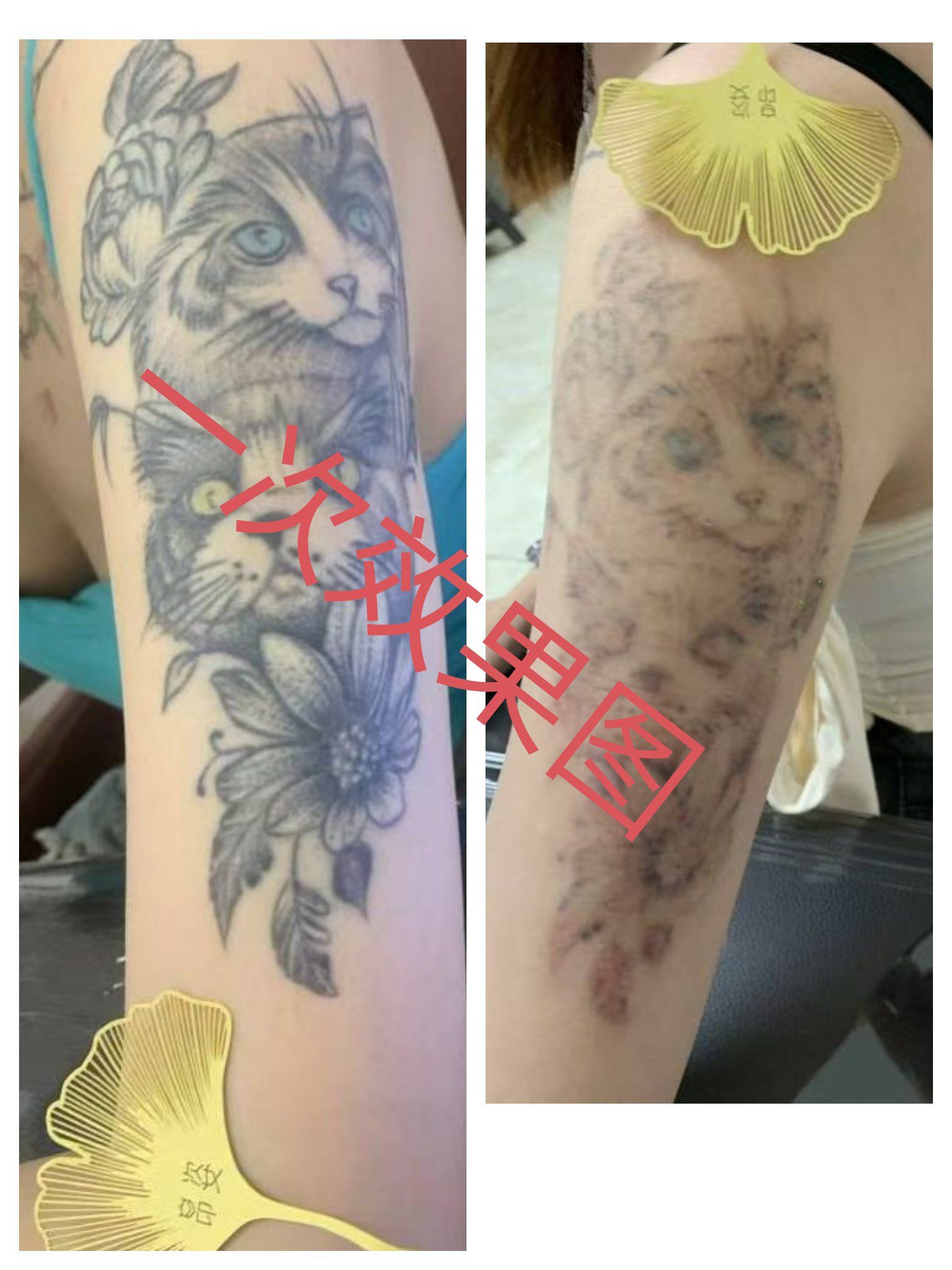 洗纹身第一次效果!