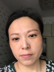 -天津健丽·去眼袋医疗美容机构