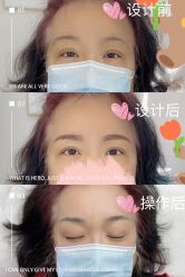 -久匠·纹眉纹绣半永久