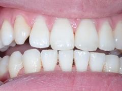 -新达口腔(华东理工大学店)