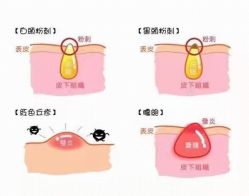 -美肤盾祛痘·问题肌头疗管理中心