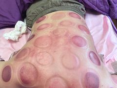 -沈师傅盲人按摩工作室(密三小区店)