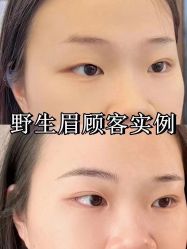 -LUNA皮相美·骨相美高级美感