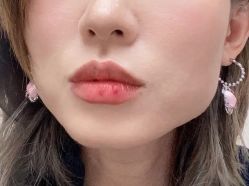 体验后-北京米扬丽格医疗美容·联合丽格鼻整形中心