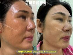 -元熙兰积皮肤管理