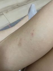 点击看大图 -天津伊美尔医疗整形美容专科医院