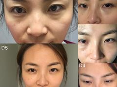 体验后-上海华安整形外科门诊部