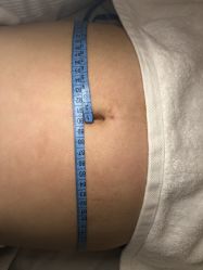 -肥三针腧穴瘦身馆