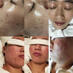 -苗方清颜痘肌研究所